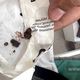 Фото Эрика Тайзидинова. Врачи извлекли из ноги военного осколки разорвавшегося снаряда