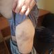 Фото Наццентра по предупреждению пыток. Следы побоев на теле пенсионера