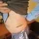 Фото Наццентра по предупреждению пыток. Следы побоев на теле пенсионера